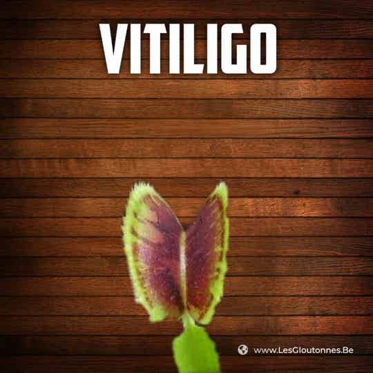 Dionaea "Vitiligo"
